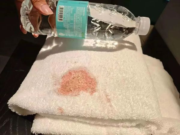 ▲▼男子入住成都飯店發現浴巾帶有血跡。（圖／翻攝大象新聞）