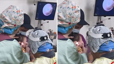 1歲女兒狂說耳朵不舒服！「裡面好像有東西」醫生一掏…佳娜：嚇死了