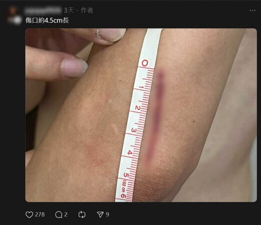 網友發文抱怨家人打流感疫苗，拔針的時候被針劃傷。（圖／翻攝自Threads）