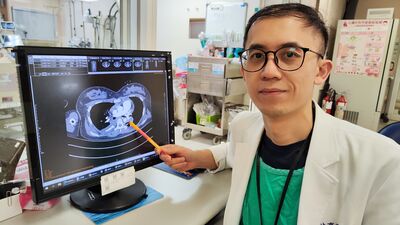 她生產隔日下床昏厥險喪命　醫示警剖腹產「靜脈血栓」比例增