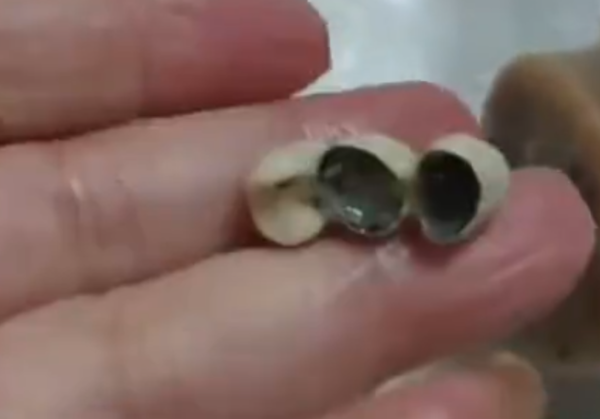 ▲▼陸女吃香腸吃到如3顆牙齒般的異物。（圖／翻攝自微博）