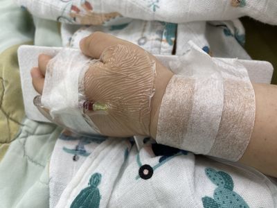 嬰染RSV「呼吸冒狗吠聲」慘住院10天 醫:死亡率比流感高5倍