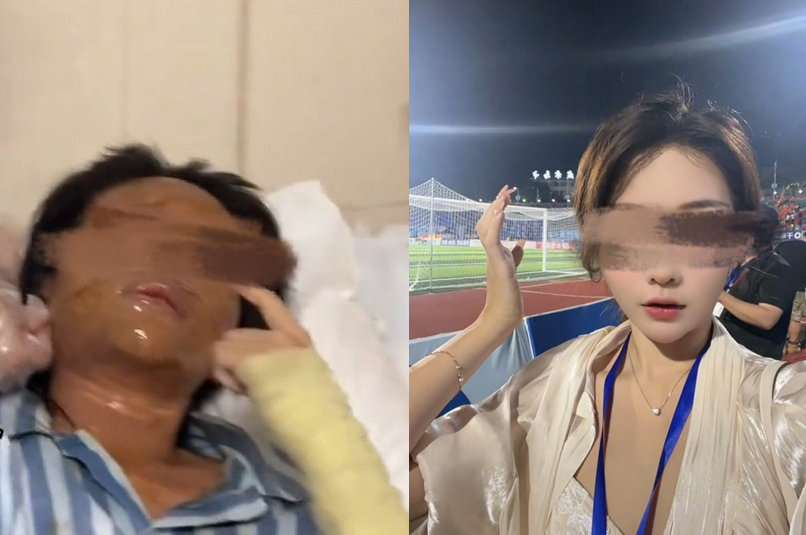 ▲▼正妹直播主打開包裹竟爆炸　毀容送醫「雙眼腫剩一條線」。（圖／翻攝自《江南都市報》）