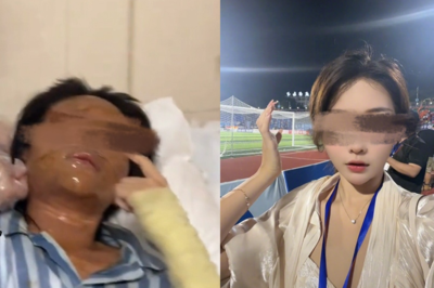 正妹直播主「開包裹爆炸」毀容　雙眼腫剩一條線
