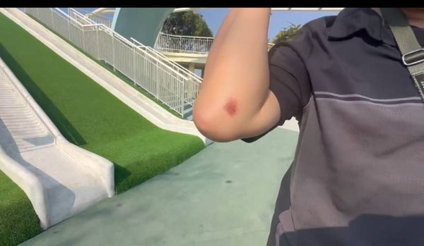 ▲國中少女到八卦山天空遊戲場玩溜滑梯骨折住院開刀。（圖／民眾提供）