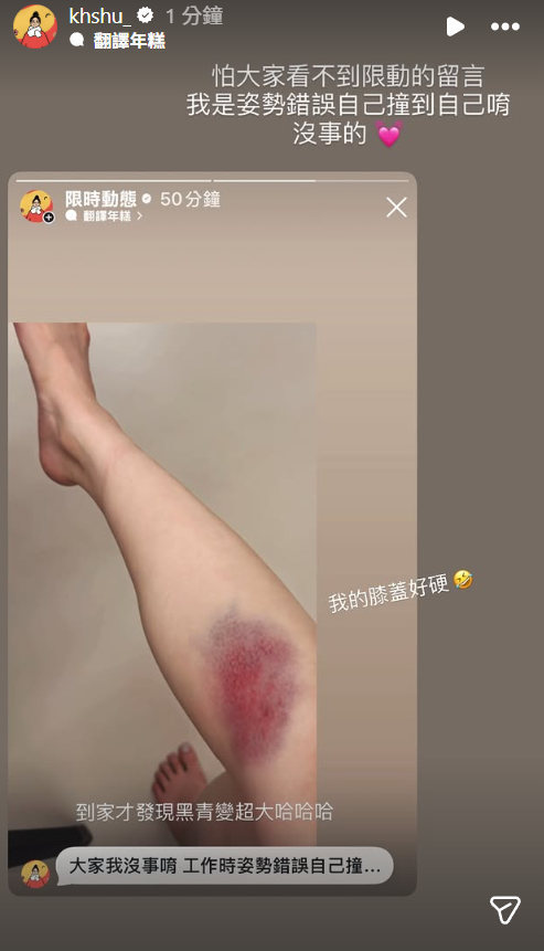 ▲▼千千PO大片瘀青照。（圖／翻攝自Instagram／khshu_）