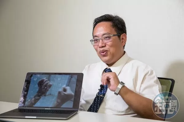 勞保權益3／90%的人不知道！　跌倒骨折也能領這筆勞保金