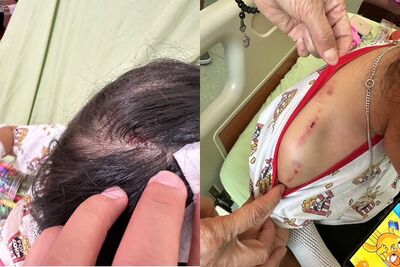 媽媽帶3女兒逛三義木雕街　店家黑狗突攻擊！2稚女慘遭咬傷