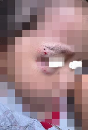 ▲苗栗一名媽媽帶著3位女兒逛木雕節，遭店家寵物犬攻擊，咬傷3歲和9歲女兒，雙方商談和解中。（圖／翻攝臉書我是三義人，下同）