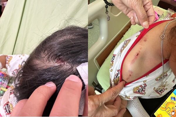 ▲苗栗一名媽媽帶著3位女兒逛木雕節，遭店家寵物犬攻擊，咬傷3歲和9歲女兒，雙方商談和解中。（圖／翻攝臉書我是三義人，下同）