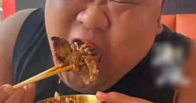 百萬粉吃播網紅體重飆到175公斤！　動切胃手術保命