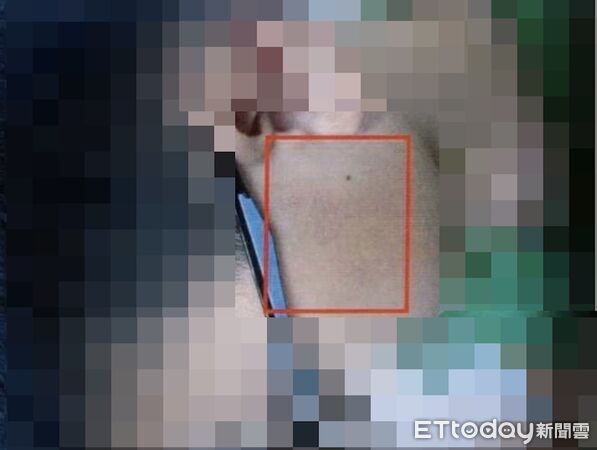 ▲▼躲避球腦震盪（圖／家長提供）