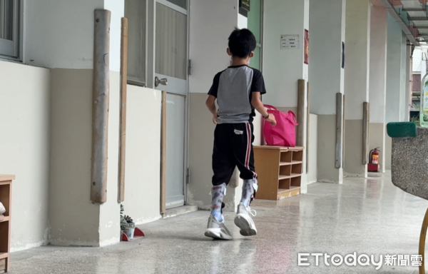 ▲▼門諾醫院義肢矯具團隊親自到家中為恩恩取模。（圖／門諾醫院提供，下同）