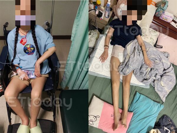 ▲▼患者出院仍四肢無力，臥床需要包尿布。（圖／家屬提供）