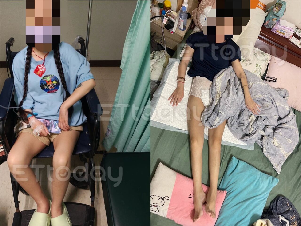 獨／家屬控縮胃減重害腦病變！音檔曝光　名醫：她貸款也堅持要開