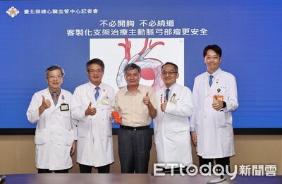 63歲男8cm動脈瘤藏腦　北榮「客製化支架」無開胸拆彈