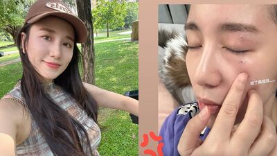 Apple臉破洞喊「我被家暴了」　兒拿玩具砸臉惹怒她：全部鎖起來