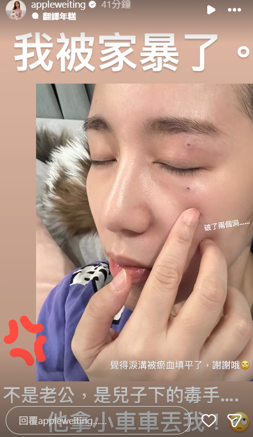 ▲▼Apple被打。（圖／翻攝自Instagram／appleweiting）