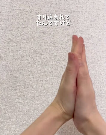 如果你從兩邊捏它們，它們就會逃跑。