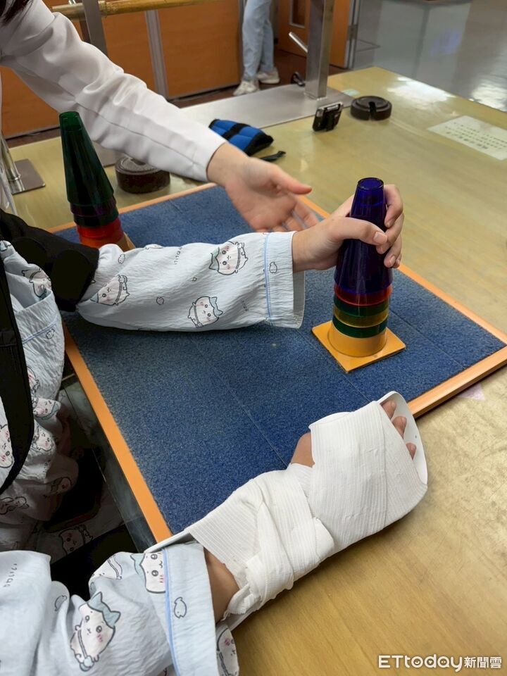 限制誘發動作療法訓練 南投醫院助中風者提升手部功能