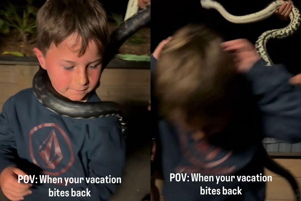 恐怖瞬間!澳洲男童動物園體驗哭了 蟒蛇「牙起來」咬頭爆血
