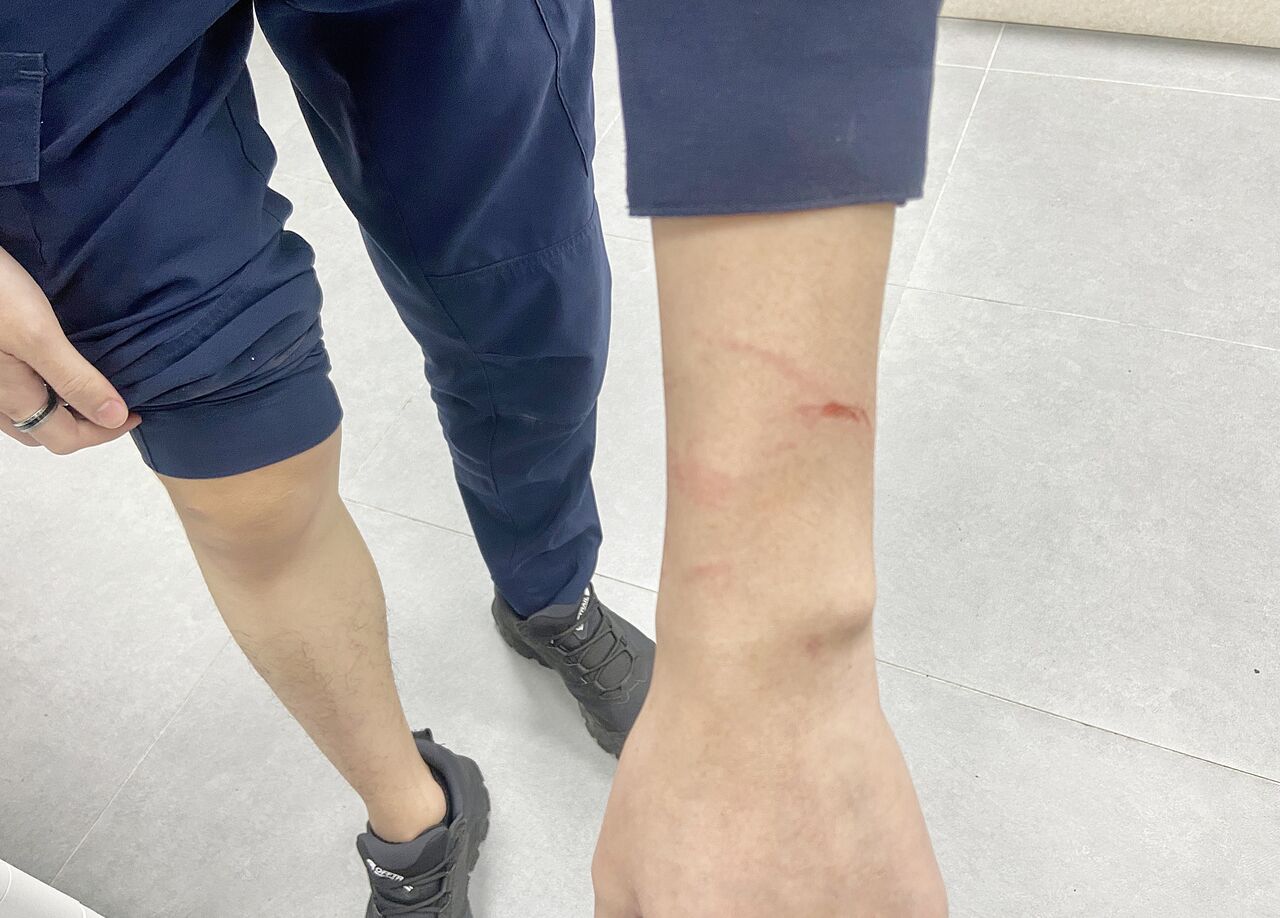 不爽老爸碎唸拿刀猛砍頭臉...還狂咬4警 桃園逆子下場慘曝