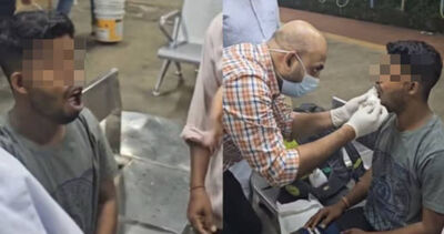 24歲男火車上下巴脫臼　醫秒趕往現場「徒手扳回去」復位