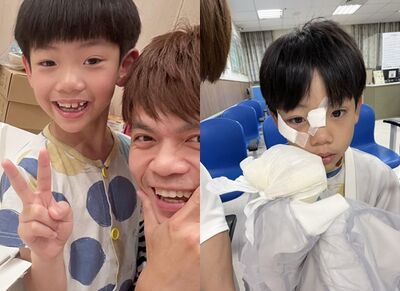 蔡桃貴連假受傷送急診！「臉上縫4針」差點傷到眼　蔡阿嘎心疼曝傷照