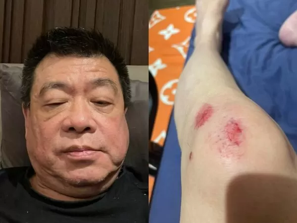 ▲▼孫德榮在家重摔。（圖／翻攝自Facebook／孫德榮）