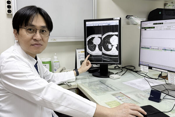 ▲▼彰基胸腔內科林聖皓主任提醒，肺腺癌初期不易察覺，若病況進展或轉移，院內仍有完整跨科團隊可應對。（圖／彰化基督教醫院提供）