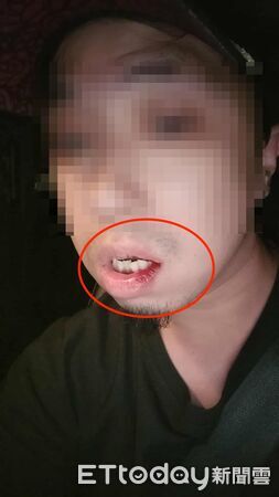 ▲▼喝醉的陳男對葉姓司機揮拳毆打，隨後再勒住葉姓司機脖子，造成葉姓司機嘴角受傷流血             。（圖／記者陳以昇翻攝）