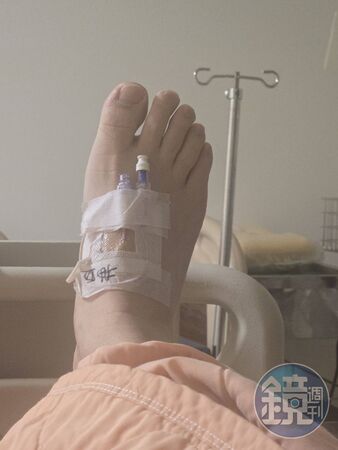 止步鬼門前／獨家！瞞老母收病危通知　洪毛爆肝險入鬼門關