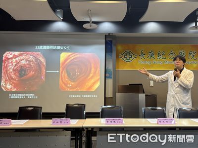 「無毒梭菌」有害！22歲女腹瀉血便2年困家中　長庚精準揪出真兇
