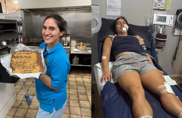 騎單車遭喜鵲突擊　女遊客「左臉直接撞地」頸部骨折奇蹟存活。（圖／翻攝自募款網站GoFundMe）