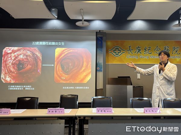 ▲▼長庚醫院今日舉辦「打造腸道理想國，長庚醫院三箭齊發，守護國人腸道健康」記者會。（圖／記者洪巧藍攝）