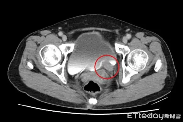 台北慈濟醫院泌尿科醫師許竣凱。（圖／院方提供）