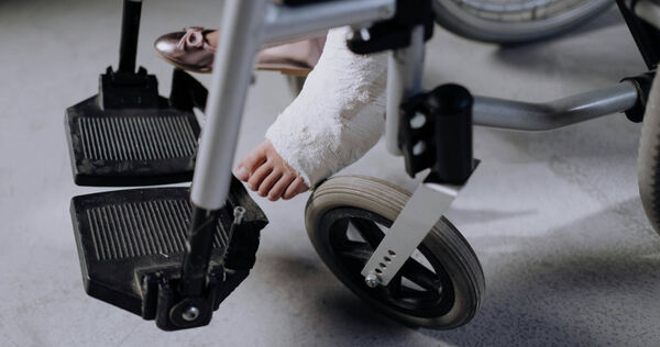 金門一名女子在搬重物時腳後跟劇痛，以為只是拉傷，休息後會自行痊癒，未料半年後小腿越來越細。（示意圖／翻攝Pexels）