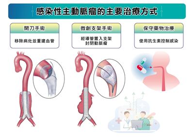 感染性主動脈瘤20年增3倍!長庚研究:開刀手術存活率優於支架