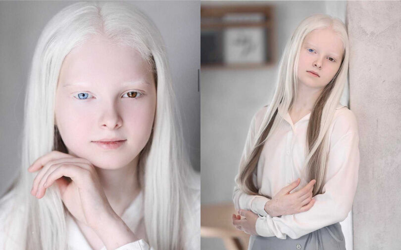 宛如天使!白化少女擁有雪白長髮與異色雙瞳 美貌震撼全球