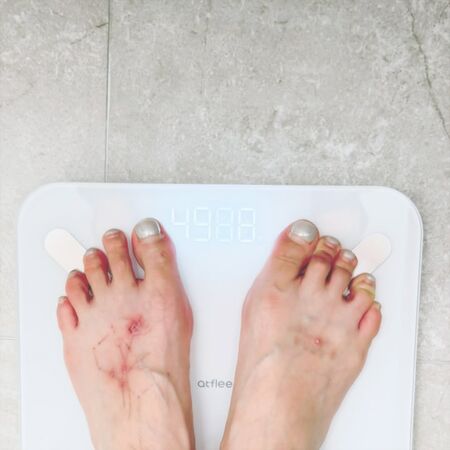 ▲▼泫雅減肥公開最新體重!「腳背都是傷」親揭原因。(圖/翻攝自Instagram/hyunah_aa)