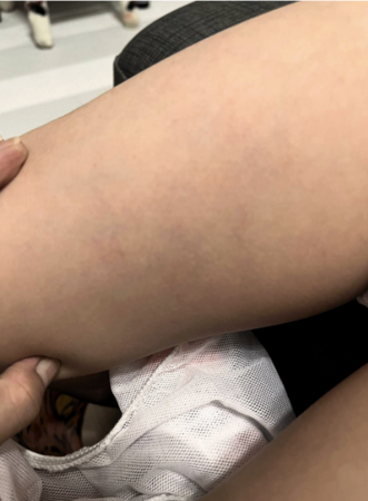 ▲北市某特教幼兒園爆出教保員不當管教學童，家長氣憤報警，教育局介入調查中。（圖／林延鳳議員辦公室提供）