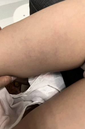 ▲北市某特教幼兒園爆出教保員不當管教學童，家長氣憤報警，教育局介入調查中。（圖／林延鳳議員辦公室提供）