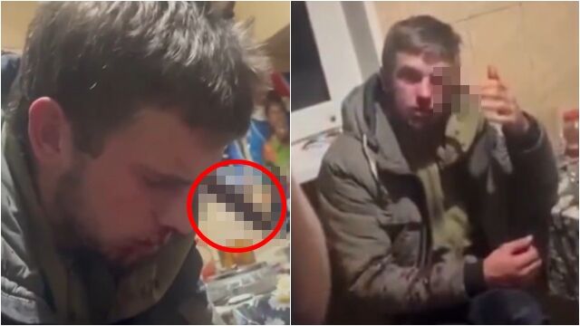 ▲▼「刀子插眼」超淡定！俄人夫遭妻砍　滿臉血問：叫救護車了嗎。（圖／翻攝X）