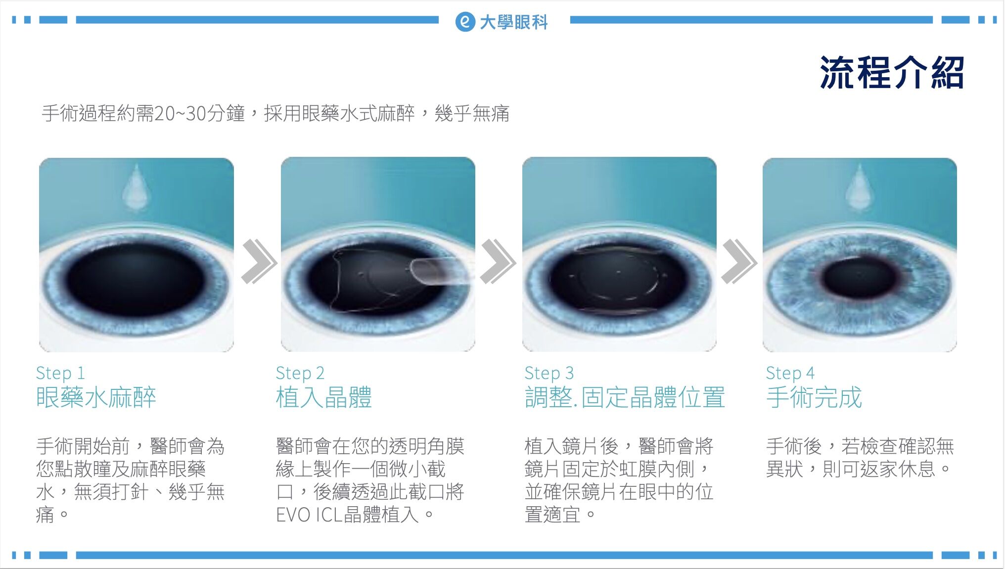 ▲▼             。（圖／大學眼科提供）