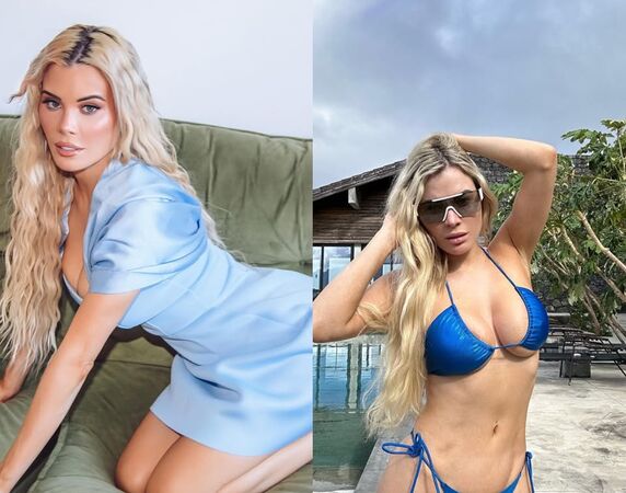 辣模整形手術後「雙眼被矇住」　病房內遭男員工掀被意圖性侵。（圖／翻攝自Instagram／carlahoweofficial）