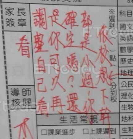 ▲老師把國二生的肩膀掐出黑青，家長帶去驗傷            。（圖／記者吳奕靖翻攝）