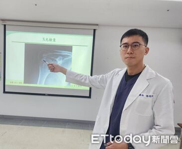 連吃3天止痛壓不下!神級髮型師「右肩廢了」…竟是鈣化搞鬼