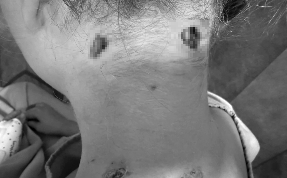 騎馬遭野生獅「飛撲咬脖」爆血見骨　21歲女遊客被拖走驚險逃死