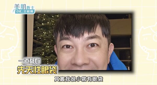 ▲▼李明川分享眼袋手術迷思。（圖／翻攝自YouTube／美肌教主DR.王朝輝）