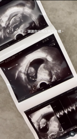 ▲▼黃沐妍。（圖／翻攝自Instagram／tystarpiggggg）